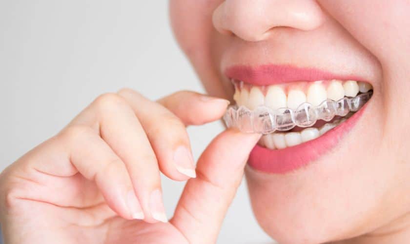 Maintaining Oral Health With Invisalign: Tips For Keeping Your Aligners And Teeth Clean